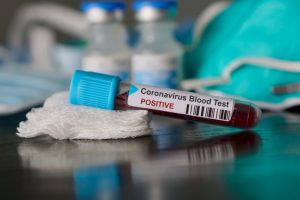 Aumento de casos de coronavirus prende las alarmas en Palmira